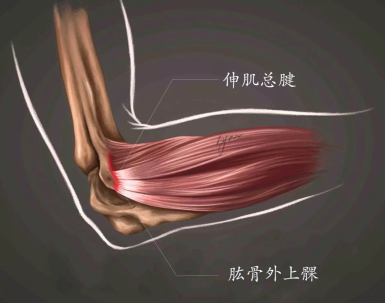 肘关节伸肌总腱位置图图片